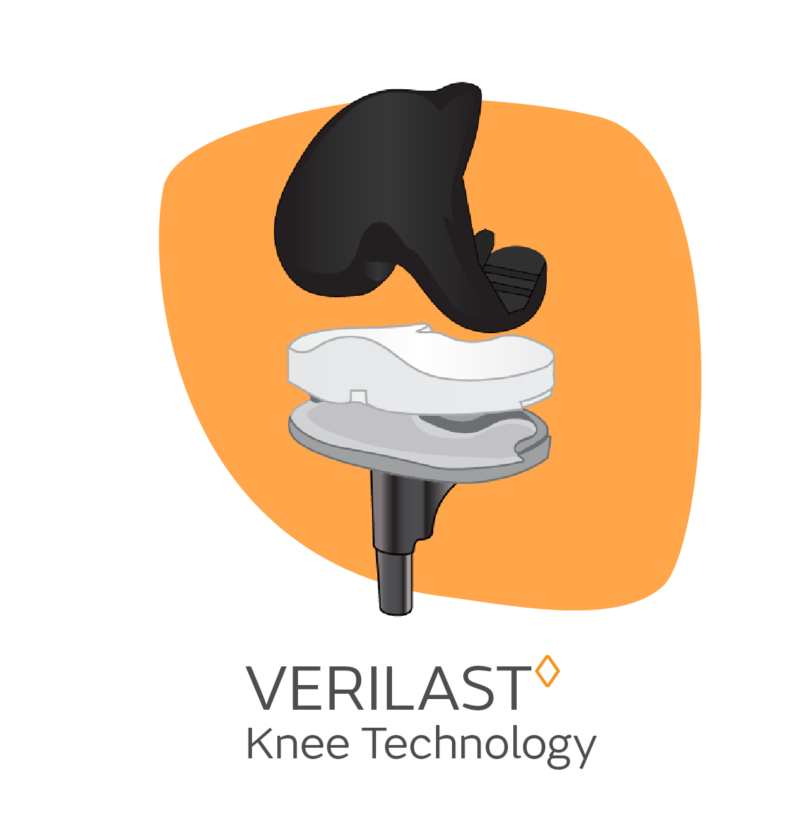 Knee Replacement Surgery with VERILAST Knee Technology